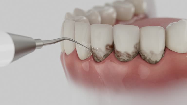 Reliable Dental contractor in Hideaway, TX by Smile Center Dentistry